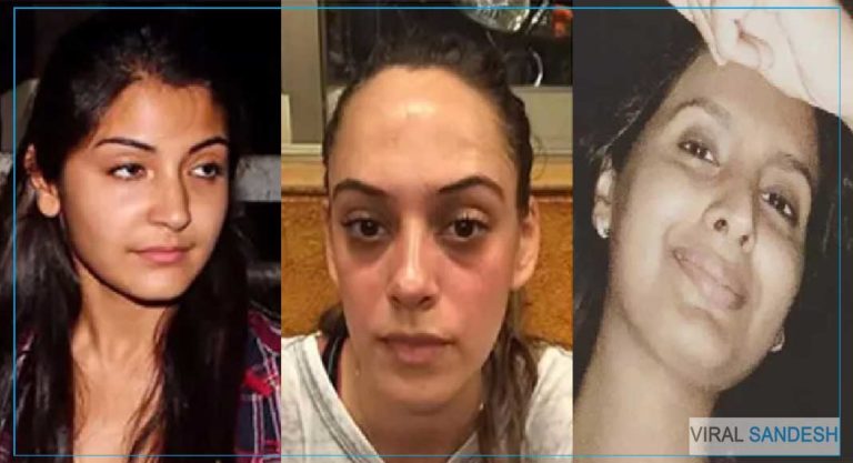 Indian Cricketer Wife Without Makeup