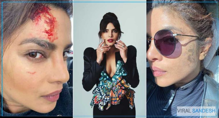 Priyanka Chopra Injured on set